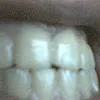 Yacine H