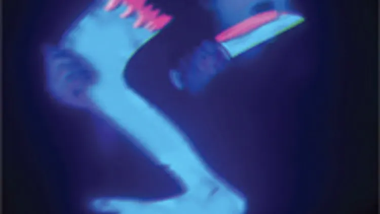 The Bewitched Hands
