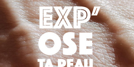 Exp’OSE TA PEAU : Un nouveau regard pour mieux vivre avec sa maladie de peau