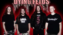Dying Fetus en concert
